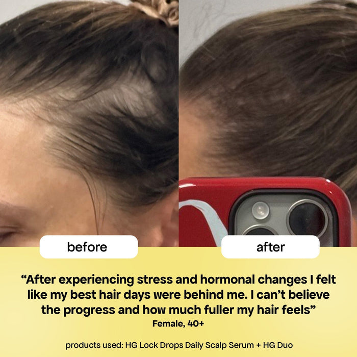 LOCK-IN THICKER HAIR: 6-MONTH SUPPLY