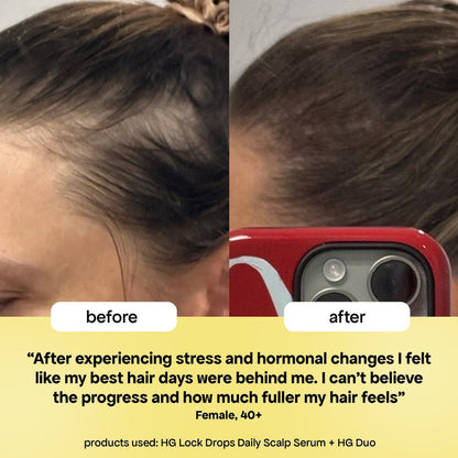 LOCK-IN THICKER HAIR: 6-MONTH SUPPLY
