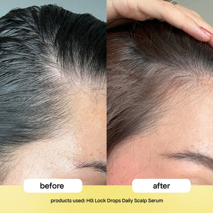 LOCK-IN THICKER HAIR: 3-MONTH SUPPLY